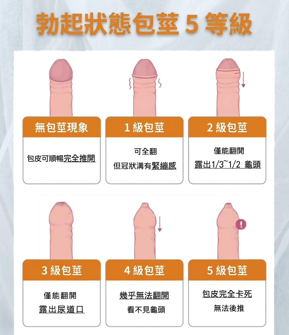 包皮發展階段示意圖