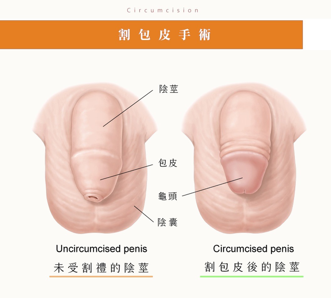 可分解線